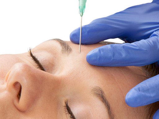 Spritze in die Region Zornesfalte bei Frau mit Botox